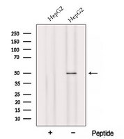 KATII / AADAT Antibody - Western blot analysis of extracts of HepG2 cells using AADAT antibody. The lane on the left was treated with blocking peptide.