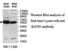KATNA1 Antibody
