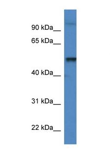 KATNA1 Antibody - KATNA1 antibody Western blot of Mouse Spleen lysate. Antibody concentration 1 ug/ml. This image was taken for the unconjugated form of this product. Other forms have not been tested.