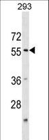 KATNA1 Antibody - KATNA1 Antibody western blot of 293 cell line lysates (35 ug/lane). The KATNA1 antibody detected the KATNA1 protein (arrow).