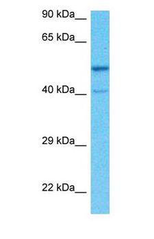 KATNA1 Antibody - Western blot of KATNA1 Antibody with human MCF7 Whole Cell lysate.  This image was taken for the unconjugated form of this product. Other forms have not been tested.
