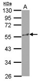 KATNA1 Antibody - Sample (30 ug of whole cell lysate) A: HepG2 10% SDS PAGE KATNA1 antibody diluted at 1:1000