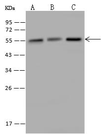 KATNA1 Antibody - Anti-KATNA1 rabbit polyclonal antibody at 1:500 dilution. Lane A: HeLa Whole Cell Lysate. Lane B: HepG2 Whole Cell Lysate. Lane C: 293 Whole Cell Lysate. Lysates/proteins at 30 ug per lane. Secondary: Goat Anti-Rabbit IgG (H+L)/HRP at 1/10000 dilution. Developed using the ECL technique. Performed under reducing conditions. Predicted band size: 56 kDa. Observed band size: 56 kDa.