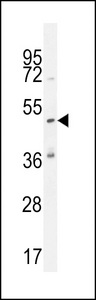 KATNAL1 Antibody - KATL1 Antibody western blot of K562 cell line lysates (35 ug/lane). The KATL1 antibody detected the KATL1 protein (arrow).