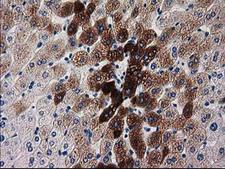 KATNAL1 Antibody - IHC of paraffin-embedded Human liver tissue using anti-KATNAL1 mouse monoclonal antibody.