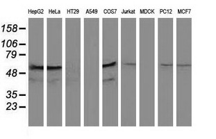 KATNAL1 Antibody - Western blot of extracts (35 ug) from 9 different cell lines by using anti-KATNAL1 monoclonal antibody (HepG2: human; HeLa: human; SVT2: mouse; A549: human; COS7: monkey; Jurkat: human; MDCK: canine; PC12: rat; MCF7: human).