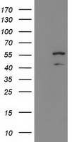 KATNAL1 Antibody - HEK293T cells were transfected with the pCMV6-ENTRY control (Left lane) or pCMV6-ENTRY KATNAL1 (Right lane) cDNA for 48 hrs and lysed. Equivalent amounts of cell lysates (5 ug per lane) were separated by SDS-PAGE and immunoblotted with anti-KATNAL1.