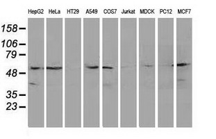 KATNAL1 Antibody - Western blot of extracts (35ug) from 9 different cell lines by using anti-KATNAL1 monoclonal antibody.