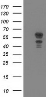 KATNAL1 Antibody - HEK293T cells were transfected with the pCMV6-ENTRY control (Left lane) or pCMV6-ENTRY KATNAL1 (Right lane) cDNA for 48 hrs and lysed. Equivalent amounts of cell lysates (5 ug per lane) were separated by SDS-PAGE and immunoblotted with anti-KATNAL1.