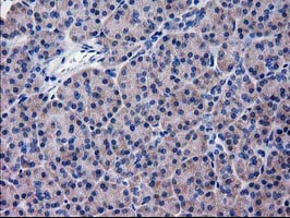 KATNAL1 Antibody - IHC of paraffin-embedded Human pancreas tissue using anti-KATNAL1 mouse monoclonal antibody.