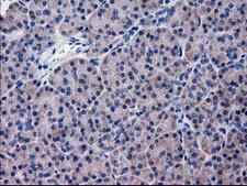 KATNAL1 Antibody - IHC of paraffin-embedded Human pancreas tissue using anti-KATNAL1 mouse monoclonal antibody.
