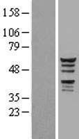 KATNAL1 Protein - Western validation with an anti-DDK antibody * L: Control HEK293 lysate R: Over-expression lysate