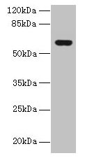 KATNAL2 Antibody - Western blot All lanes: KATNAL2 antibody at 1µg/ml + U251 whole cell lysate Secondary Goat polyclonal to rabbit IgG at 1/10000 dilution Predicted band size: 62, 53 kDa Observed band size: 62 kDa