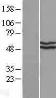 KATNAL2 Protein - Western validation with an anti-DDK antibody * L: Control HEK293 lysate R: Over-expression lysate