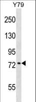 KATNB1 Antibody - KATNB1 Antibody western blot of Y79 cell line lysates (35 ug/lane). The KATNB1 antibody detected the KATNB1 protein (arrow).