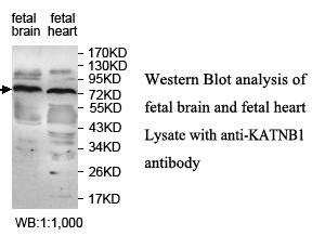 KATNB1 Antibody