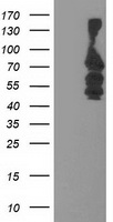 KATNB1 Antibody - HEK293T cells were transfected with the pCMV6-ENTRY control (Left lane) or pCMV6-ENTRY KATNB1 (Right lane) cDNA for 48 hrs and lysed. Equivalent amounts of cell lysates (5 ug per lane) were separated by SDS-PAGE and immunoblotted with anti-KATNB1.