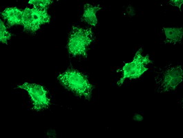 KATNB1 Antibody - Anti-KATNB1 mouse monoclonal antibody immunofluorescent staining of COS7 cells transiently transfected by pCMV6-ENTRY KATNB1.