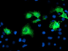 KATNB1 Antibody - Anti-KATNB1 mouse monoclonal antibody immunofluorescent staining of COS7 cells transiently transfected by pCMV6-ENTRY KATNB1.