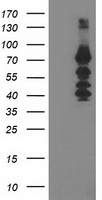 KATNB1 Antibody - HEK293T cells were transfected with the pCMV6-ENTRY control (Left lane) or pCMV6-ENTRY KATNB1 (Right lane) cDNA for 48 hrs and lysed. Equivalent amounts of cell lysates (5 ug per lane) were separated by SDS-PAGE and immunoblotted with anti-KATNB1.