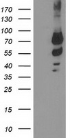 KATNB1 Antibody - HEK293T cells were transfected with the pCMV6-ENTRY control (Left lane) or pCMV6-ENTRY KATNB1 (Right lane) cDNA for 48 hrs and lysed. Equivalent amounts of cell lysates (5 ug per lane) were separated by SDS-PAGE and immunoblotted with anti-KATNB1.