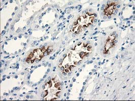 KATNB1 Antibody - IHC of paraffin-embedded Human Kidney tissue using anti-KATNB1 mouse monoclonal antibody.
