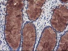 KATNB1 Antibody - IHC of paraffin-embedded Human colon tissue using anti-KATNB1 mouse monoclonal antibody.