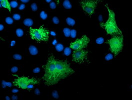 KATNB1 Antibody - Anti-KATNB1 mouse monoclonal antibody immunofluorescent staining of COS7 cells transiently transfected by pCMV6-ENTRY KATNB1.