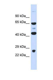 KBTBD10 / Sarcosin Antibody - Western blot of Human Fetal Muscle. KLHL41 antibody dilution 1.0 ug/ml.  This image was taken for the unconjugated form of this product. Other forms have not been tested.