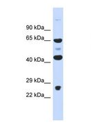 KBTBD10 / Sarcosin Antibody - Western blot of Human Fetal Muscle. KLHL41 antibody dilution 1.0 ug/ml.  This image was taken for the unconjugated form of this product. Other forms have not been tested.