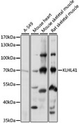 KBTBD10 / Sarcosin Antibody - Western blot analysis of extracts of various cell lines, using KLHL41 antibody at 1:1000 dilution. The secondary antibody used was an HRP Goat Anti-Rabbit IgG (H+L) at 1:10000 dilution. Lysates were loaded 25ug per lane and 3% nonfat dry milk in TBST was used for blocking. An ECL Kit was used for detection and the exposure time was 1s.