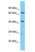 KBTBD11 Antibody - KBTBD11 antibody Western Blot of Jurkat. Antibody dilution: 1 ug/ml.  This image was taken for the unconjugated form of this product. Other forms have not been tested.