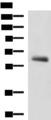 KBTBD11 Antibody - Western blot analysis of Human metastatic papillary carcinoma(thyroid cancer) tissue lysate  using KBTBD11 Polyclonal Antibody at dilution of 1:2300