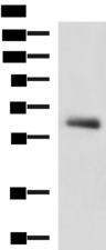 KBTBD11 Antibody - Western blot analysis of Human metastatic papillary carcinoma(thyroid cancer) tissue lysate  using KBTBD11 Polyclonal Antibody at dilution of 1:2300