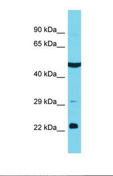 KBTBD12 Antibody - Western blot of Human MCF7. KBTBD12 antibody dilution 1.0 ug/ml.  This image was taken for the unconjugated form of this product. Other forms have not been tested.