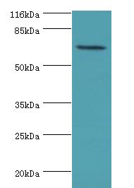 KBTBD2 Antibody - Western blot. All lanes: KBTBD2 antibody at 2 ug/ml+A549 whole cell lysate. Secondary antibody: Goat polyclonal to rabbit at 1:10000 dilution. Predicted band size: 71 kDa. Observed band size: 71 kDa.  This image was taken for the unconjugated form of this product. Other forms have not been tested.