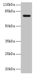 KBTBD2 Antibody - Western blot All lanes: KBTBD2 antibody at 2µg/ml + A549 whole cell lysate Secondary Goat polyclonal to rabbit IgG at 1/10000 dilution Predicted band size: 71 kDa Observed band size: 71 kDa