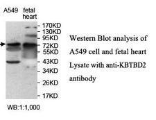 KBTBD2 Antibody