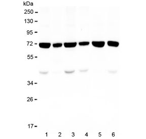 KBTBD2 Antibody - Western blot testing of human 1) HeLa, 2) placenta, 3) K562, 4) U-2 OS, 5) ThP1 and 6) A549 lysate with KBTBD2 antibody at 0.5ug/ml. Predicted molecular weight ~71 kDa.