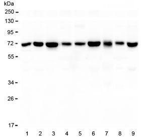 KBTBD2 Antibody - Western blot testing of 1) rat brain, 2) rat heart, 3) rat kidney, 4) rat ovary, 5) mouse brain, 6) mouse heart, 7) mouse kidney, 8) mouse testis and 9) mouse SP2/0 lysate with KBTBD2 antibody at 0.5ug/ml. Predicted molecular weight ~71 kDa.