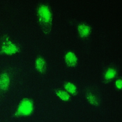 KBTBD2 Antibody - IF/ICC staining of FFPE human A549 cells with KBTBD2 antibody at 2ug/ml. HIER: steam section in pH6 citrate buffer for 20 min.
