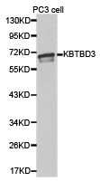 KBTBD3 Antibody - Western blot of extracts of PC3 cell lines, using KBTBD3 antibody.