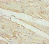 KBTBD3 Antibody - Immunohistochemistry of paraffin-embedded human skeletal muscle tissue at dilution 1:100