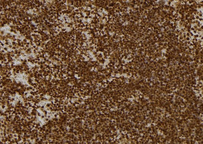 KBTBD3 Antibody - 1:100 staining mouse spleen tissue by IHC-P. The sample was formaldehyde fixed and a heat mediated antigen retrieval step in citrate buffer was performed. The sample was then blocked and incubated with the antibody for 1.5 hours at 22°C. An HRP conjugated goat anti-rabbit antibody was used as the secondary.