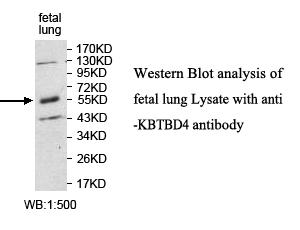 KBTBD4 Antibody
