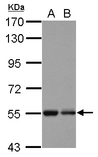 KBTBD4 Antibody - Sample (30 ug of whole cell lysate) A: U87-MG B: SK-N-SH 7.5% SDS PAGE KBTBD4 antibody diluted at 1:1000