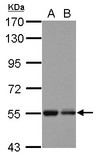 KBTBD4 Antibody - Sample (30 ug of whole cell lysate) A: U87-MG B: SK-N-SH 7.5% SDS PAGE KBTBD4 antibody diluted at 1:1000