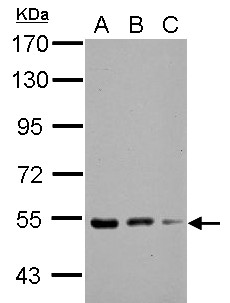 KBTBD4 Antibody - Sample (30 ug of whole cell lysate) A: NIH-3T3 B: JC C: BCL-1 7.5% SDS PAGE KBTBD4 antibody diluted at 1:1000