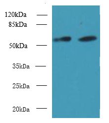 KBTBD4 Antibody - Western blot. All lanes: KBTBD4 antibody at 10 ug/ml. Lane 1: U87 whole cell lysate. Lane 2: NIH/3T3 whole cell lysate. Secondary Goat polyclonal to Rabbit IgG at 1:10000 dilution. Predicted band size: 58 kDa. Observed band size: 58 kDa.
