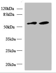 KBTBD4 Antibody - Western blot All lanes: KBTBD4 antibody at 10µg/ml Lane 1: U87 whole cell lysate Lane 2: NIH/3T3 whole cell lysate Secondary Goat polyclonal to rabbit IgG at 1/10000 dilution Predicted band size: 59, 60 kDa Observed band size: 59 kDa